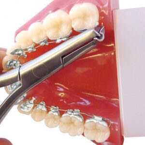 kềm bẻ dây cung phía xa