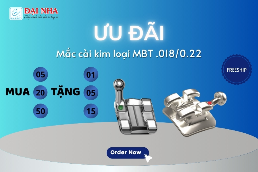 Ưu đãi mắc cài kim loại