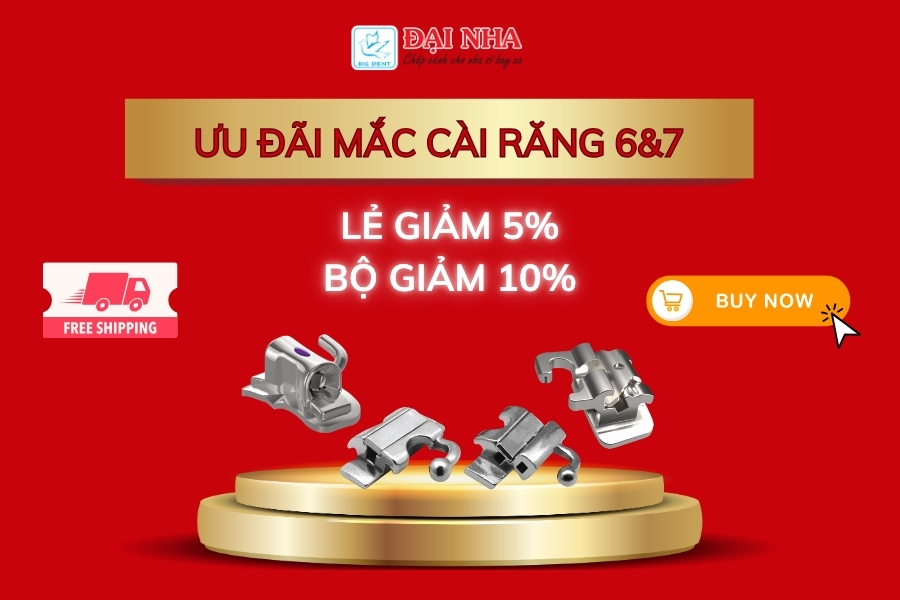 Ưu đãi mắc cài răng 6&7