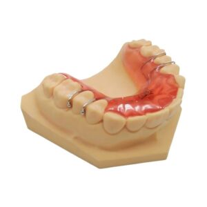 tấm hướng dẫn mặt phẳng hàm trên
