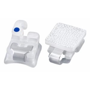 mắc cài sứ tự buộc