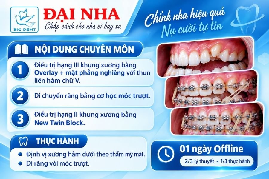 khóa học chỉnh nha chuyên sâu